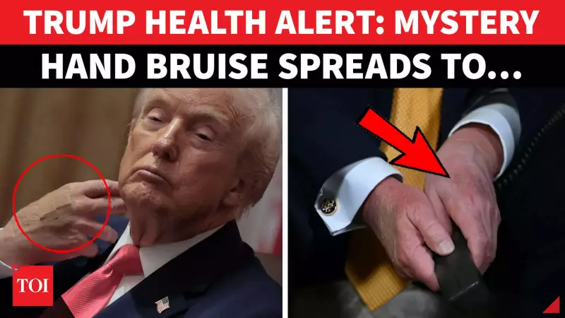 Trump's Hand Bruise Sparks Health Debate: White House Under Scrutiny