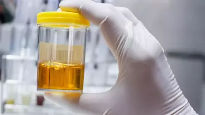 Cloudy Urine: 5 Common Causes from Dehydration to UTI & When to Worry