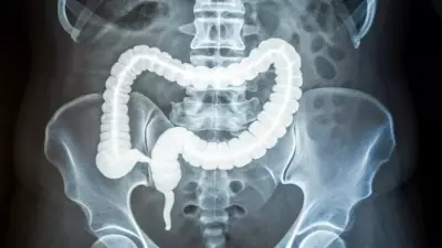 Stiff Colon Tissue: A New Early Warning Sign for Rising Colorectal Cancer in Young Adults