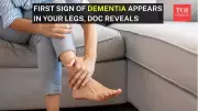 Dementia Warning Signs: Weak Legs Could Signal Risk, Says AIIMS Neurosurgeon