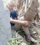 French Tourist Critically Injured After 2-Day Ordeal at Hampi World Heritage Site