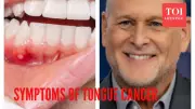 Full House Star Dave Coulier's Tongue Cancer: Symptoms & Key Facts