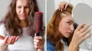Hair Fall After 40 in Women: Key Causes, Signs, and Effective Treatments