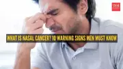 Nasal Cancer: Rising Risk for Men, Key Symptoms & Prevention Tips