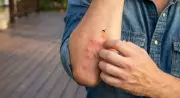 Why Mosquitoes Bite You More? Science Explains CO2, Blood Type & Clothing