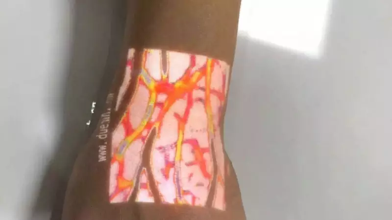 Chinese Vein Finder Goes Viral in India: Portable Device Projects Live Vein Maps