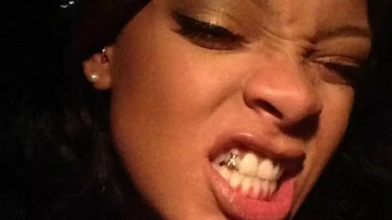 Dentists Warn: Rihanna's Tooth Gems Trend Poses Serious Dental Health Risks