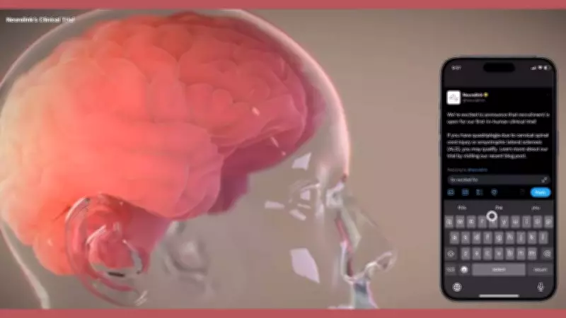 Elon Musk's Neuralink Prepares for First Human Implant of Vision-Restoring Brain Device