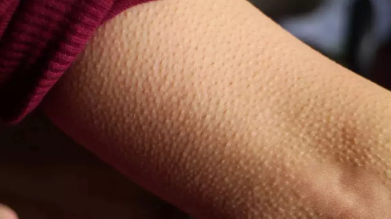 Goosebumps: More Than Just Chills - The Hidden Science of Skin Bumps