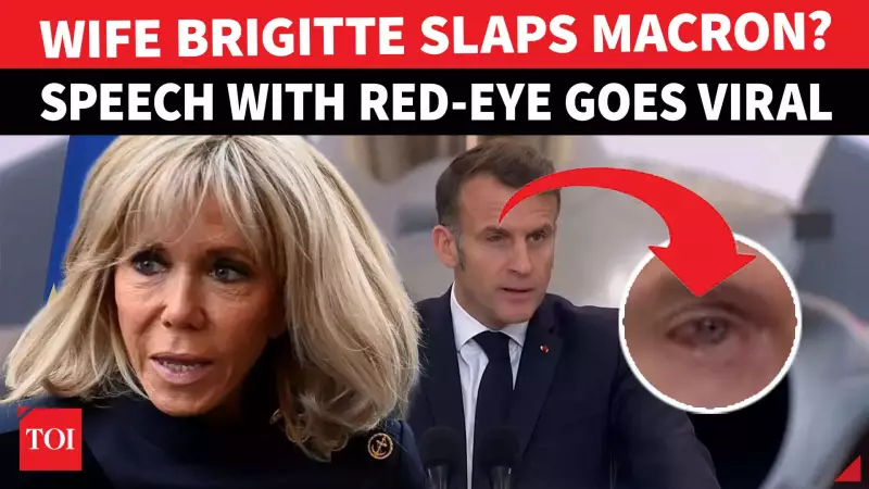 Macron's Red Eye Sparks Rumors of Clash with Brigitte, French President Denies
