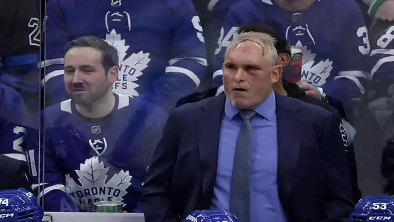 Maple Leafs Coach Craig Berube Shows Leadership Through Gym Injury