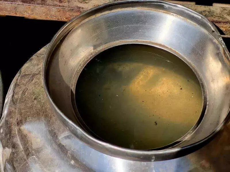 Pune's GBS Outbreak Legacy: Systemic Gaps Persist One Year After Crisis