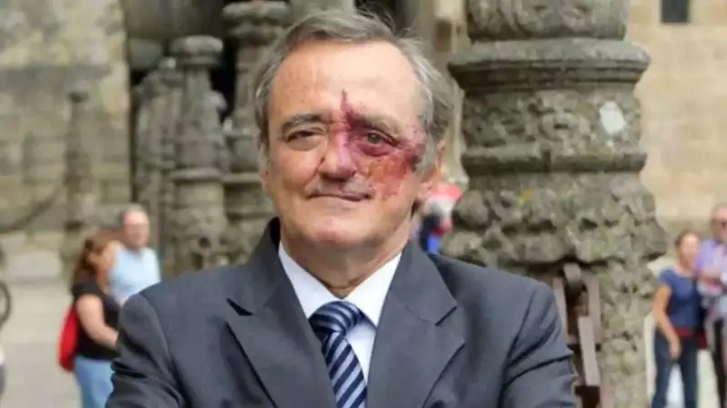 Spanish Scientists Report Preclinical Breakthrough in Pancreatic Cancer Treatment