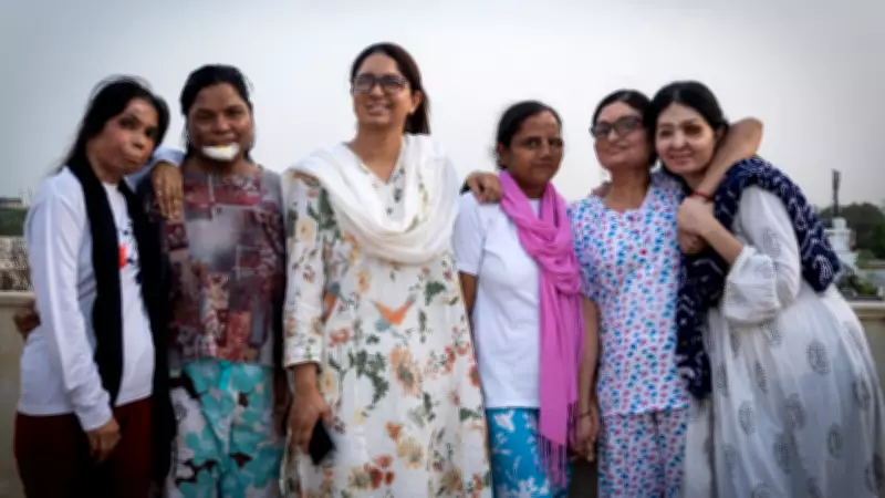 Supreme Court Flags Need for Extraordinary Punitive Measures in Acid Attack Cases