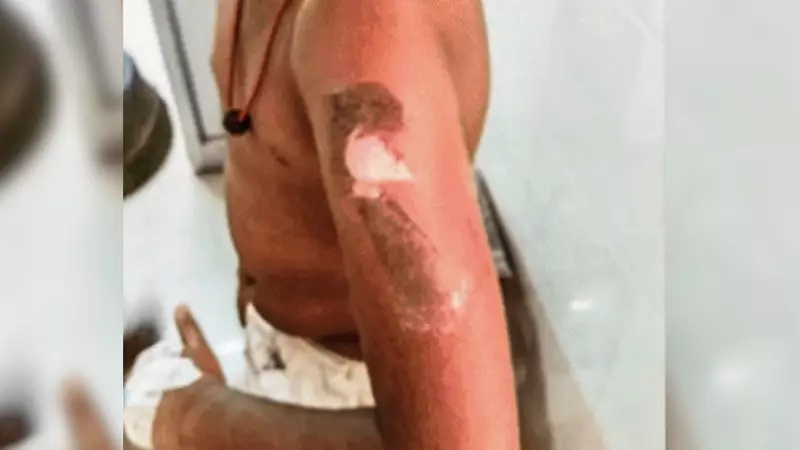 Vellore Farmer Brands 10-Year-Old Son with Hot Knife for Not Waking Up for School