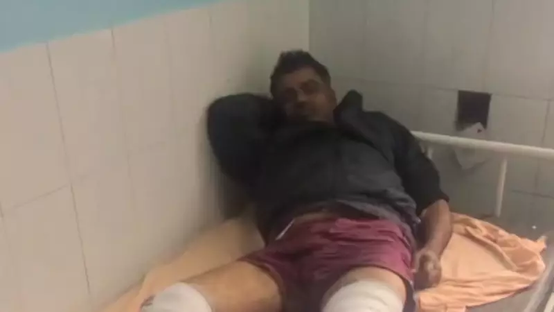 Wanted Criminal with ₹1 Lakh Reward Shot, Arrested After Gurgaon Encounter