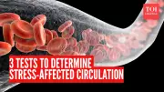 3 Simple Tests to Check if Stress is Damaging Your Blood Circulation