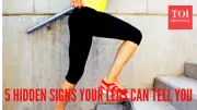 5 Leg Signs That Warn of Hidden Diseases: Doctor Explains
