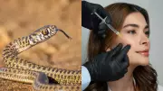 Botox Could Help Snakebite Victims by Reducing Tissue Damage, Study Finds
