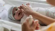 Doctor Warns: Oiling Baby's Face Can Worsen Newborn Acne, Affects 30% Infants