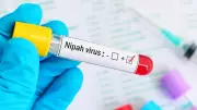 Nipah Virus: Two Nurses Shifted to Kolkata Hospital, Condition Critical
