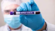 Nipah Virus vs. Other Viral Infections: Key Differences Explained