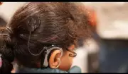 Patna Aims for 500 Cochlear Implants by Mid-2026 in Deafness-Free Mission
