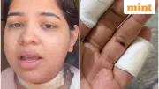 Pune Woman's Terrifying Manjha Attack Sparks Public Safety Outrage