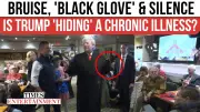 Trump's Black Glove Sparks Health Rumors: 'Festering Rot' Theories Erupt Online