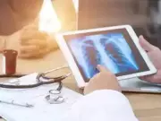 UP Launches 100-Day Intensive TB Detection Drive Targeting Vulnerable Groups