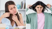 Why Teens Get Pimples & Oily Hair: A Dermatologist Explains the Science