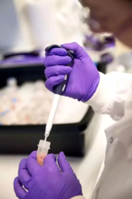 3D-Printed Titanium Skull Implant Saves Uzbek Woman with Rare Brain Herniation