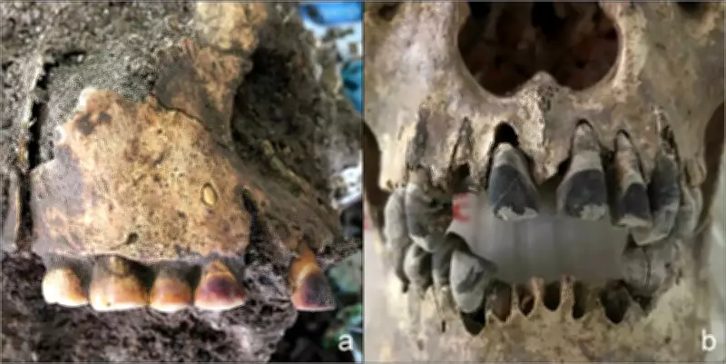 Ancient Vietnamese Teeth Reveal 2,000-Year-Old Cosmetic Blackening Practice