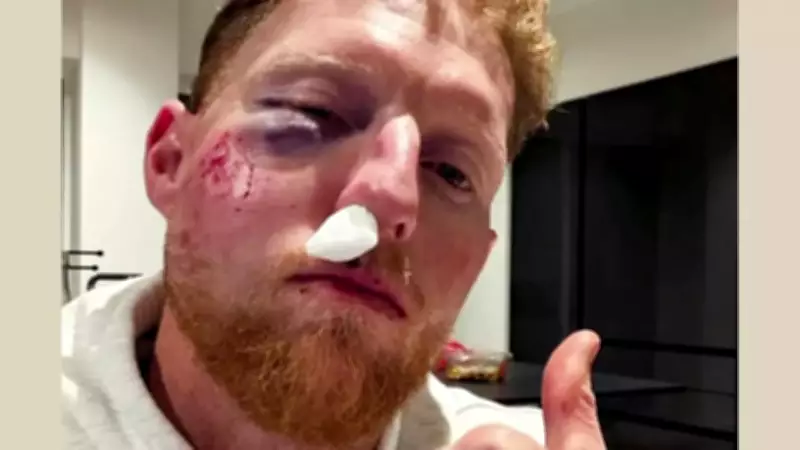 Ben Stokes Undergoes Surgery After Cricket Ball Injury, Vows to Always Wear Helmet