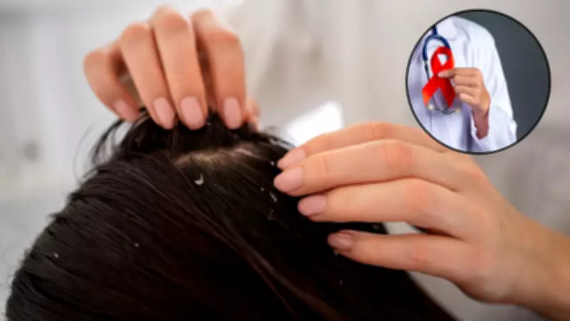 Can Dandruff Be a Hidden Sign of HIV? Expert Debunks Viral Social Media Claim