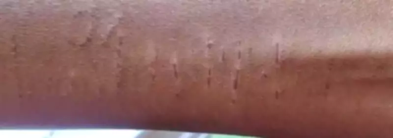 Chhattisgarh School Incident: 35 Students Self-Harm, Collector Issues Notice