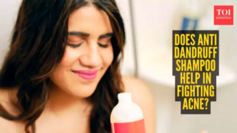 Dermatologists Debunk Viral Trend: Anti-Dandruff Shampoo for Acne