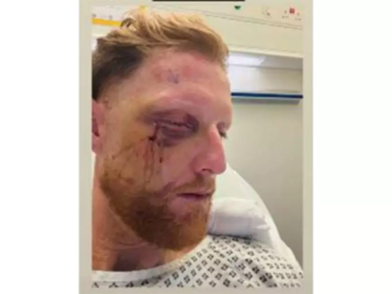England Test Captain Ben Stokes Recovers After Successful Facial Surgery