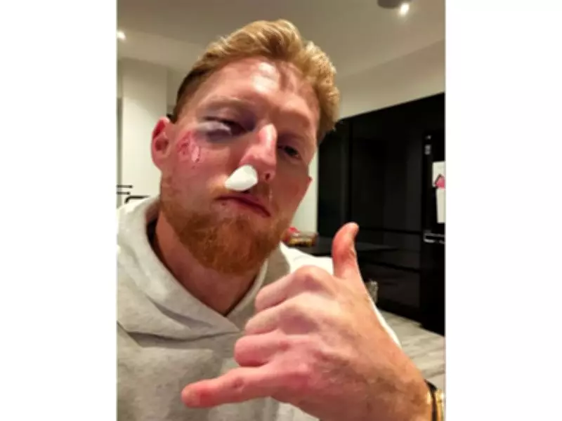 England Test Captain Ben Stokes Sustains Facial Injury During Practice Session