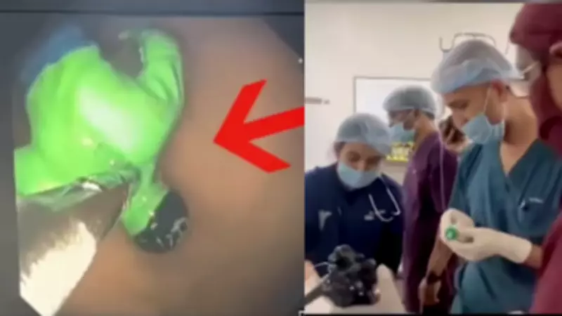 Gujarat Boy Swallows Hulk Toy, Doctors Perform Life-Saving Endoscopic Removal