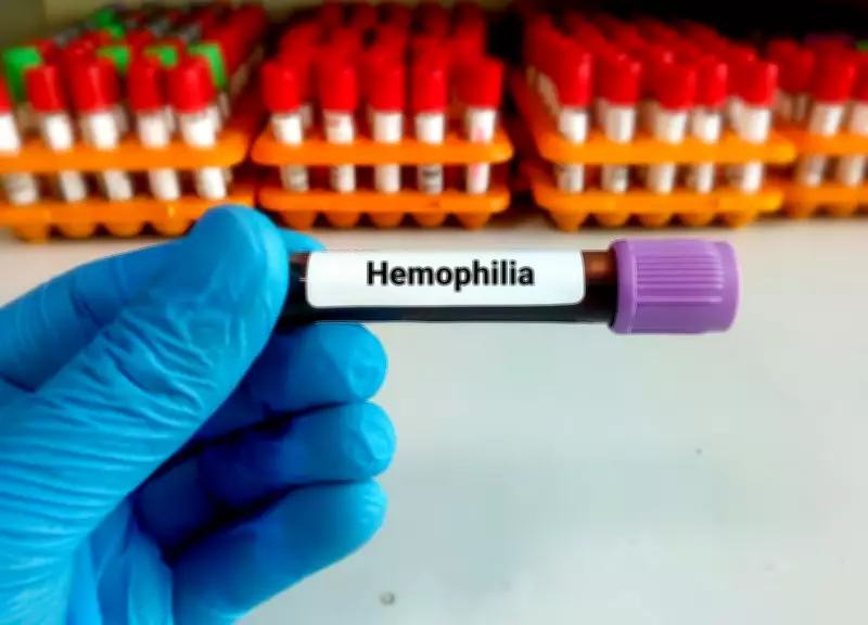 Haemophilia: A Rare Genetic Disorder That Can Be Managed Effectively