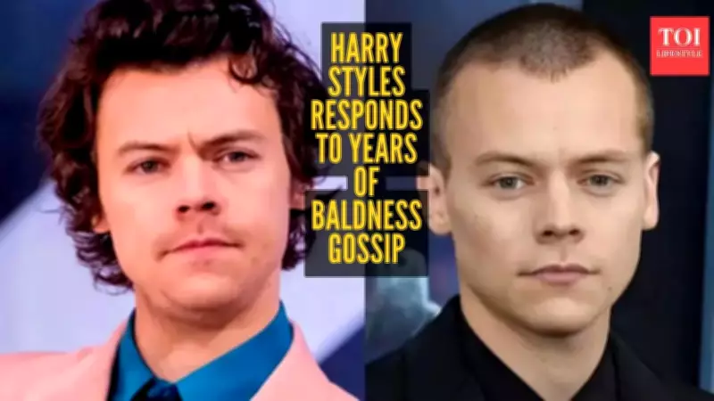 Harry Styles Jokes About Hairline Rumors, Embraces Humor Over Internet Speculation