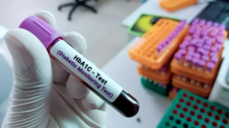 HbA1c Test May Mislead Diabetes Diagnosis in India, Lancet Review Warns