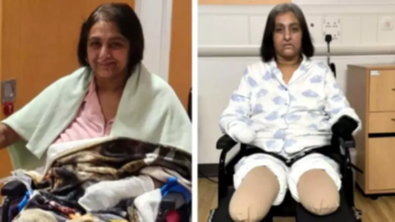 Indian-Origin Woman Survives Sepsis After Dog Lick, Loses Limbs in Quadruple Amputation