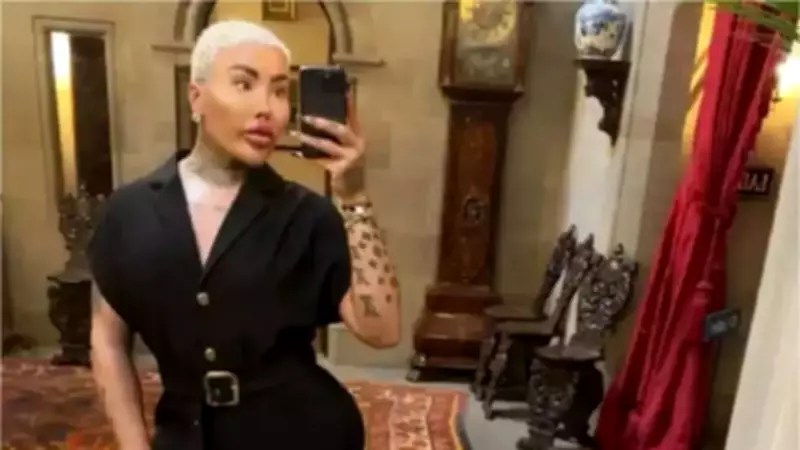 Influencer Jordan James Parke, 'Lip King' from 'Botched,' Dies at 34 After Cosmetic Procedures