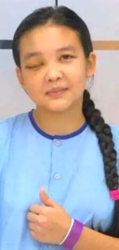 Kazakh Teen Regains Sight After Complex Eye Tumor Surgery in Ghaziabad Hospital