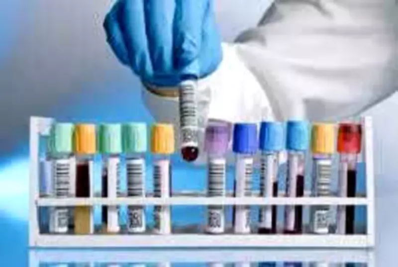 KGMU's New Fund to Slash Diagnostic Test Costs by 70% for Patients