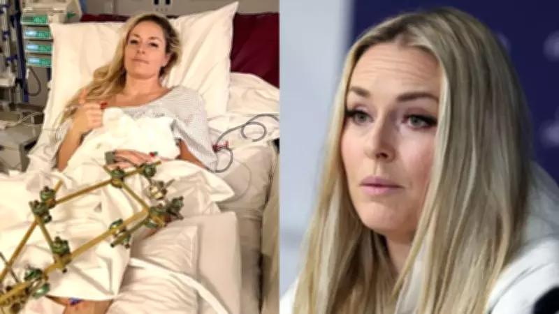 Lindsey Vonn's Olympic Dream Ends with Third Surgery, Father Confirms Career Over