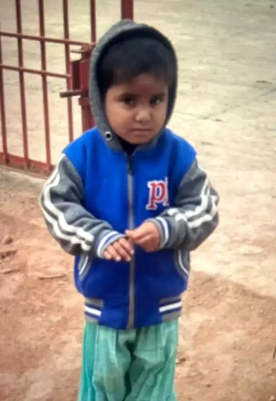 Ludhiana: Stray Dog Attack Injures 3-Year-Old Child, Sparking Safety Concerns