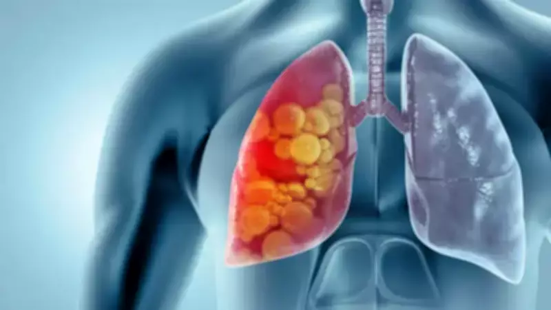 Mumbai's Lung Cancer Crisis: Non-Smokers at Rising Risk as Adenocarcinoma Dominates